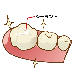 予防歯科